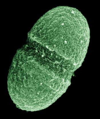 Imagen: El microorganismo patógeno, Enterococcus faecalis, escogido para la detección por la nueva tecnología (Fotografía cortesía del Departamento de Agricultura de los Estados Unidos).